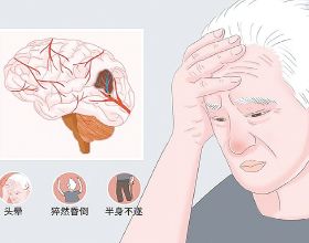 「每日一藥」 抗腫瘤藥物&mdash;&mdash;卡培他濱片