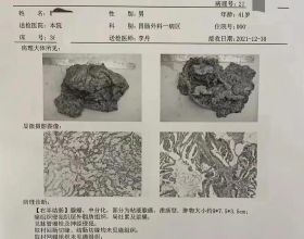 安卓13訊息，這次加入可以遊戲中提升cpu速度的指令集？