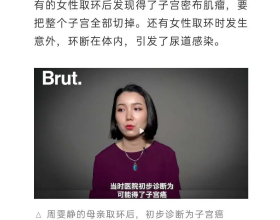 “殘害一代中國女性”的節育環，今日我想為它說上幾句公道話