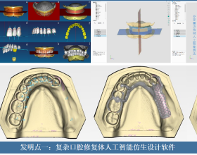 為了患者“好牙口”，他們用人工智慧、3D列印與仿生材料“重塑”牙齒