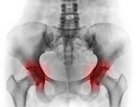 WIN10 19044.1566 LTSC 無更新純淨精簡版 / 精簡最佳化系統