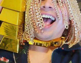 墨西哥Rapper頭皮植入數十條大金鍊，搞了一頭名副其實的金髮