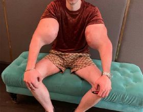 俄羅斯25歲男子為變超人，大臂注射6升類固醇，為保命上了手術檯