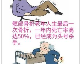家有老人請注意，“人生最後一次骨折”，年死亡率可達50%