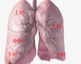 肺結節手術後對生活有哪些影響？