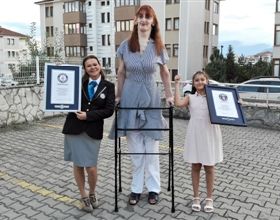 土耳其一女子創造新世界紀錄 身高2.15米行走需要支架