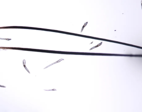 顯微鏡下，20多條蟎蟲在睫毛上爬，愛化眼妝的你知道這些危害嗎？