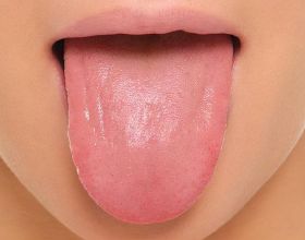 脾胃不好，舌苔白厚有齒痕、舌頭有裂痕，該怎麼調理？