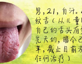 舌頭有裂紋是怎麼回事？常見的裂紋舌辯證，看看你是哪一種？