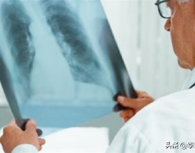 如何讓你的肺結節變小或者消失？