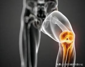 膝關節咔咔作響，上下樓疼痛不適，髕骨軟化症到底該如何治療