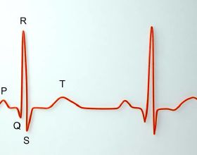 體檢心電圖提示“竇性心律”，是什麼病？心血管醫生告訴你
