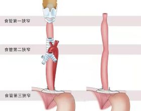 顏值超高！倍思100W充電套裝限時138元秒殺