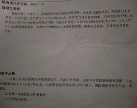 一身之火匯於肺！三味藥小方子，清肺熱、洩肺火、止肺咳