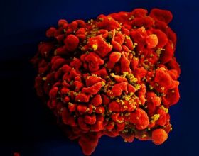 艾滋病CRISPR基因編輯療法獲FDA批准 將進入人體測試階段