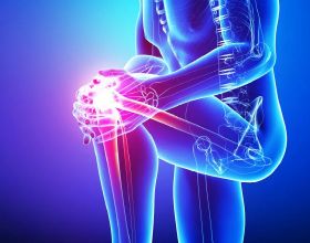 【受試者招募】膝關節骨性關節炎人群，這項臨床研究瞭解一下