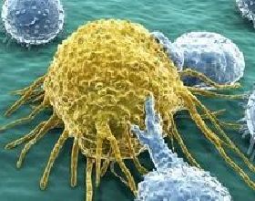 「Science」癌細胞還有什麼狡猾的手段來逃脫免疫系統？科學家帶你一探究竟