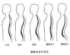 氟斑牙治不好？老牙醫：這幾個方法可以改善