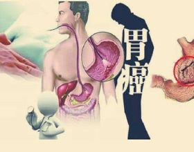 法拉第未來回應訂單資料造假，1.4萬輛訂單僅300輛為付費預訂