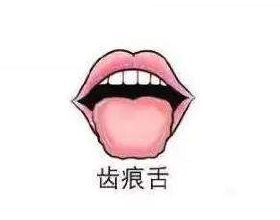 經常感覺背疼，5種原因逐一排查，試試3種鍛鍊方法，預防腰背痛