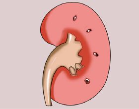 《賽博朋克 2077》1.5 更新後 PC 版崩潰，官方給出解決方案