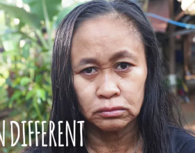 16歲菲律賓少女迅速衰老成60歲老人的臉，尋遍醫生後找出心酸病因