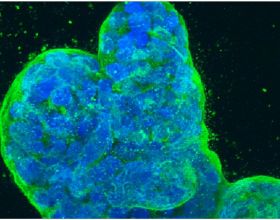 Cell：促進癌症的雌激素受體ERα也會導致癌症抗藥性