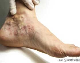 耶魯大學在Science發表重磅研究，限制熱量攝入，可以延長壽命