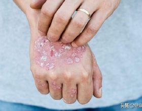 我要增肥啊增到竹鼠那麼胖