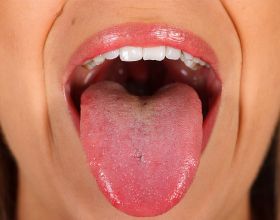 “舌為心之苗”：心臟不好，舌頭或許有4個變化，對照自查下