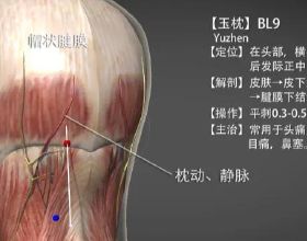 牙齒矯正想選隱形牙套？戴前你必須要知道這些事