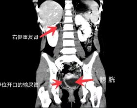 金彭、雅迪、步步先推出新電動三輪車，車型小巧，主打代步與載人