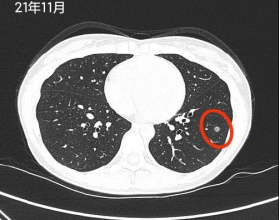 于光遠 活到老 玩到老