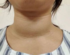 昨天，我的閨女走了