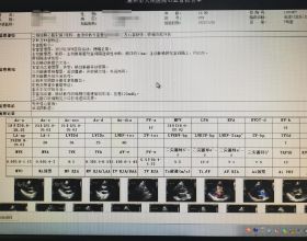 三款熱銷的低價手機，每一款都有諸多看點，為你詳細解讀配置