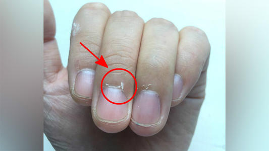 孩子指甲一天一個樣?瞭解這些才能科學成長 孩子指甲一天一個樣?瞭解這些才能科學成長