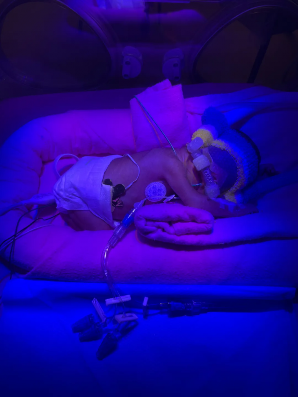 “我的孩子在新加坡早產,只有1kg重!面臨35萬天價賬單......” “我的孩子在新加坡早產,只有1kg重!面臨35萬天價賬單......”