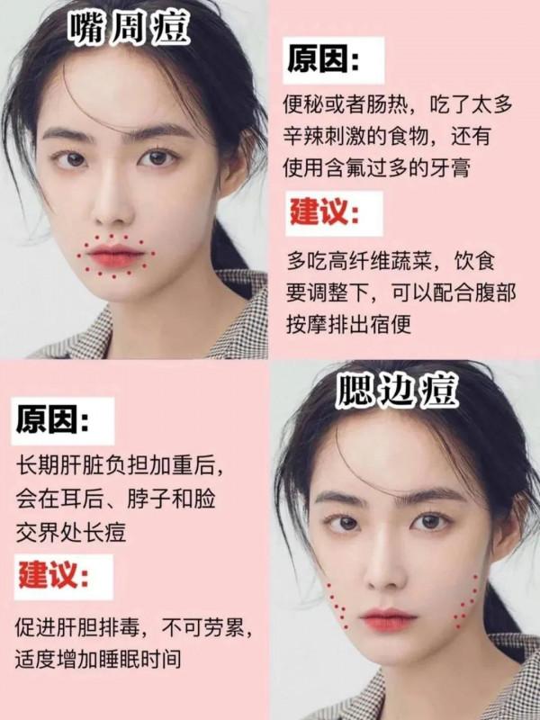 你需要的護膚小知識‘長痘原因’