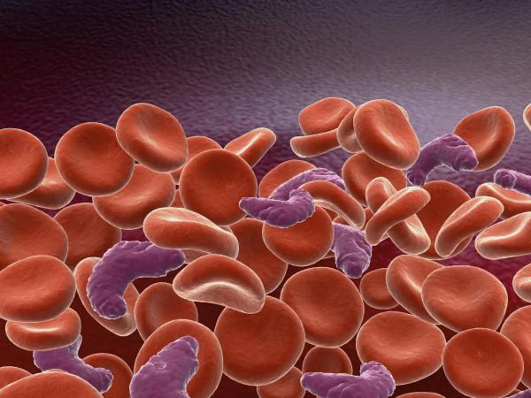 “白血病”專挑孩子下手，家長注意：孩子有5個異常，需及時排查