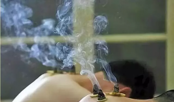 中醫治療頸椎病大全，全是乾貨