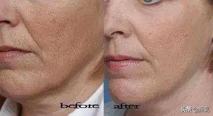 越努力越沒眼看,為什麼南韓女明星個個精緻又腫脹? 越努力越沒眼看,為什麼南韓女明星個個精緻又腫脹?