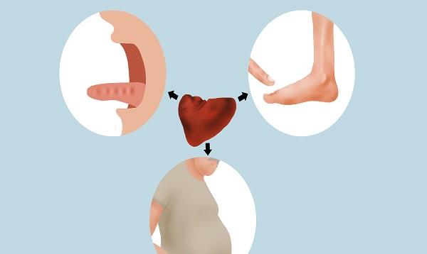 脾胃不好，舌苔白厚有齒痕、舌頭有裂痕，該怎麼調理？