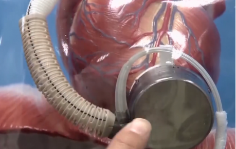 知料 | 給身體換個“零件”,用人造器官“續命” 知料 | 給身體換個“零件”,用人造器官“續命”