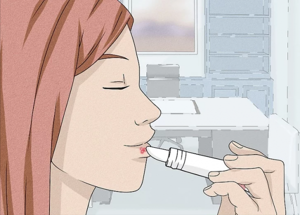 如何治癒唇皰疹外殼