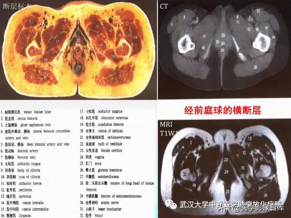 CT斷層解剖圖譜最全總結「推薦收藏」 CT斷層解剖圖譜最全總結「推薦收藏」