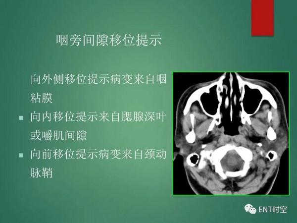 頭頸五官CT斷層解剖圖及常見病影像診斷