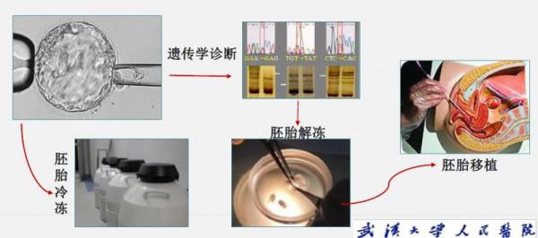 攜帶遺傳致病基因的父母,如何生下健康後代?武漢大學人民醫院這個團隊給出解決方案 攜帶遺傳致病基因的父母,如何生下健康後代?武漢大學人民醫院這個團隊給出解決方案