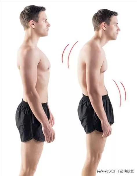 如何透過有效訓練消除圓肩和駝背