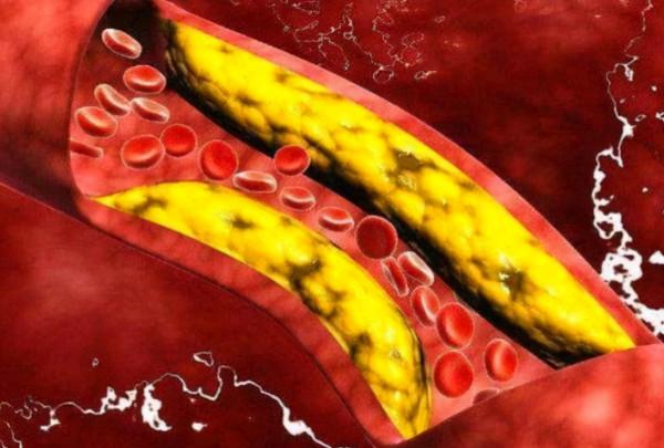 過了50歲,體檢時這6個指標都正常,恭喜身體保養得還不錯 過了50歲,體檢時這6個指標都正常,恭喜身體保養得還不錯