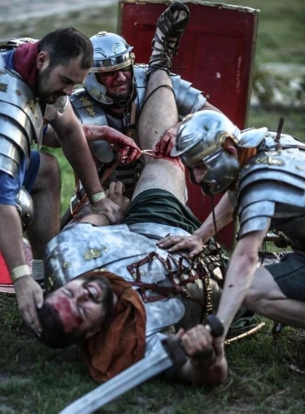 遠遠領先時代的羅馬帝國軍醫——直到二十世紀才被超越